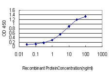 10 - RAB39B Antibody (monoclonal) (M01) AT3524a