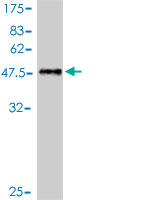 1 - RAB39B Antibody (monoclonal) (M01) AT3524a