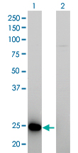 1 - RAB39B Antibody (monoclonal) (M01) AT3524a