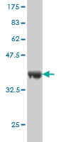 1 - RAB43 Antibody (monoclonal) (M01) AT3528a