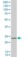 1 - RAB43 Antibody (monoclonal) (M01) AT3528a