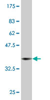 1 - RAB43 Antibody (monoclonal) (M09) AT3529a