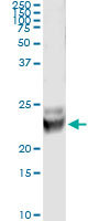 5 - RAB7B Antibody (monoclonal) (M01) AT3533a