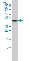 1 - RABGGTB Antibody (monoclonal) (M02) AT3539a