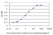 10 - RABIF Antibody (monoclonal) (M01) AT3540a