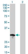 1 - RABL2B Antibody (monoclonal) (M01) AT3541a
