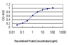 10 - RAD54B Antibody (monoclonal) (M01) AT3552a