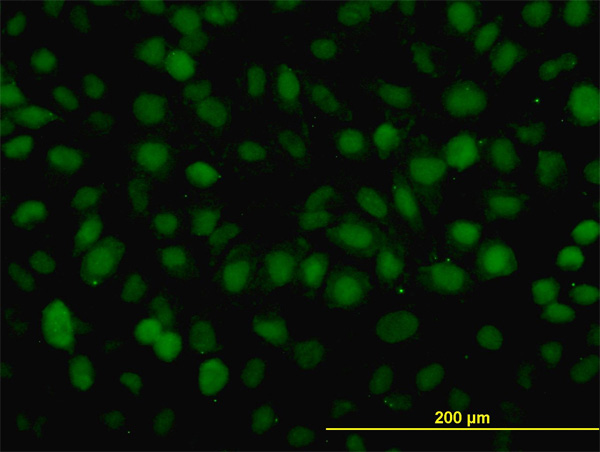3 - RAD54B Antibody (monoclonal) (M01) AT3552a