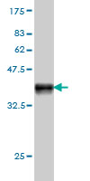 1 - RAD54B Antibody (monoclonal) (M01) AT3552a