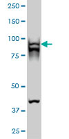 1 - RAD54B Antibody (monoclonal) (M01) AT3552a