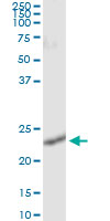 5 - RALB Antibody (monoclonal) (M04) AT3553a