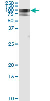 5 - RALBP1 Antibody (monoclonal) (M02) AT3555a