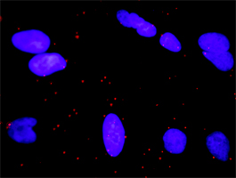 1 - RALGDS Antibody (monoclonal) (M01) AT3556a