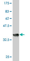 1 - RAPGEF2 Antibody (monoclonal) (M01) AT3566a