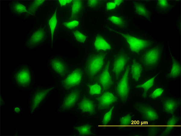 3 - RAPGEF6 Antibody (monoclonal) (M01) AT3568a