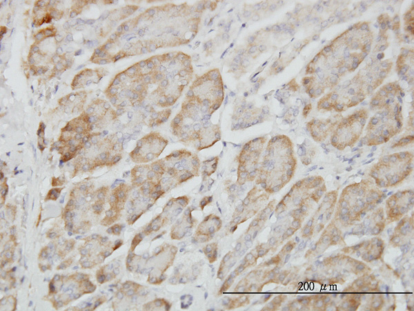 2 - RAPGEF6 Antibody (monoclonal) (M01) AT3568a