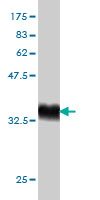 1 - RAPGEF6 Antibody (monoclonal) (M01) AT3568a