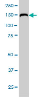 1 - RAPGEF6 Antibody (monoclonal) (M01) AT3568a