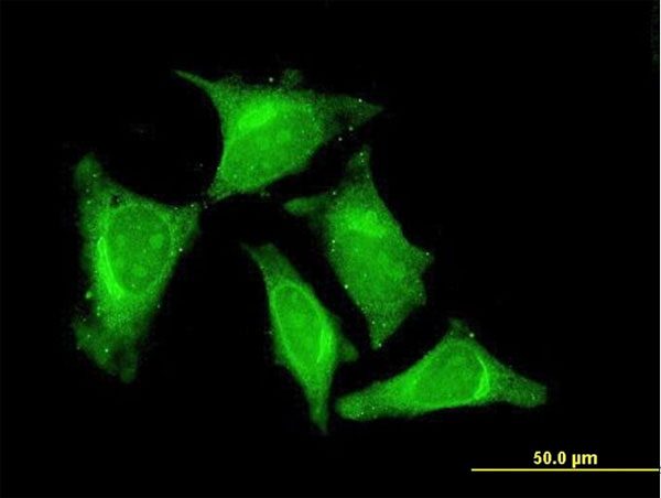 3 - RASGEF1C Antibody (monoclonal) (M01) AT3578a