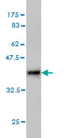 1 - RASGEF1C Antibody (monoclonal) (M01) AT3578a