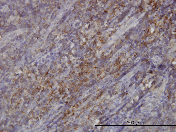 2 - RASGRP4 Antibody (monoclonal) (M01) AT3580a
