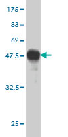 1 - RASGRP4 Antibody (monoclonal) (M01) AT3580a