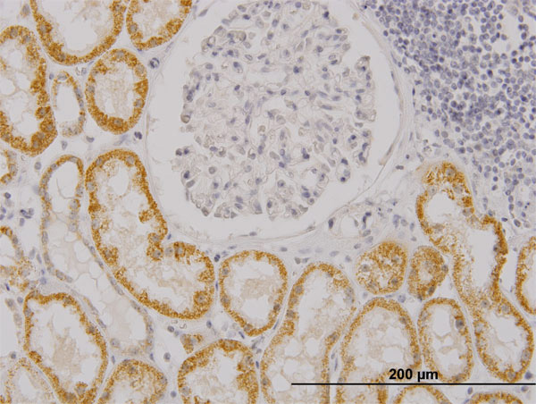 2 - RASGRP4 Antibody (monoclonal) (M02) AT3581a