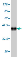 1 - RASGRP4 Antibody (monoclonal) (M02) AT3581a