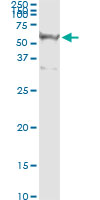 5 - RASSF8 Antibody (monoclonal) (M01) AT3583a