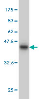 1 - RBM9 Antibody (monoclonal) (M01) AT3593a