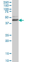 1 - RBM9 Antibody (monoclonal) (M01) AT3593a