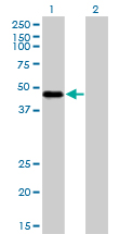 1 - RBM9 Antibody (monoclonal) (M01) AT3593a
