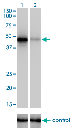 1 - RBM9 Antibody (monoclonal) (M01) AT3593a