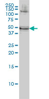 1 - RBMS1 Antibody (monoclonal) (M02) AT3596a