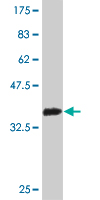 1 - RBP3 Antibody (monoclonal) (M01) AT3600a