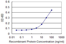 10 - RCN1 Antibody (monoclonal) (M01) AT3606a