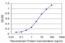 10 - RCV1 Antibody (monoclonal) (M07) AT3608a