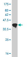 1 - RCV1 Antibody (monoclonal) (M07) AT3608a