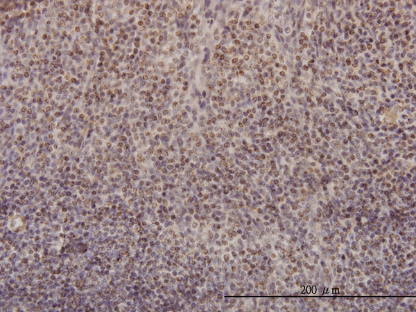 2 - RFC4 Antibody (monoclonal) (M01) AT3621a