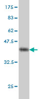 1 - RFC4 Antibody (monoclonal) (M01) AT3621a