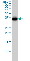 1 - RFC4 Antibody (monoclonal) (M01) AT3621a