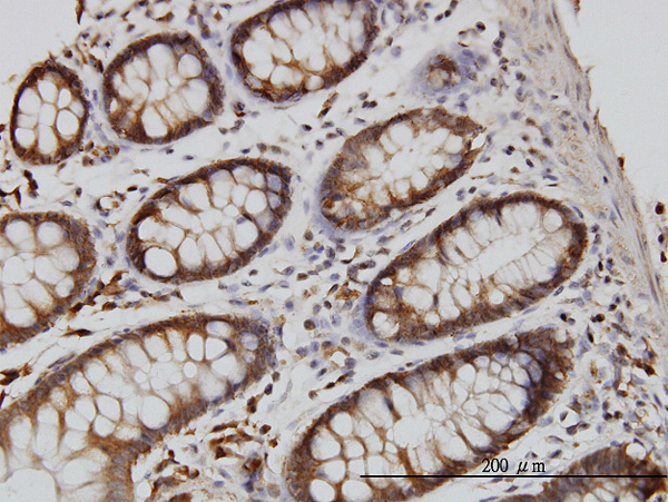2 - RGL1 Antibody (monoclonal) (M01) AT3626a