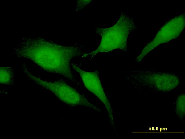 3 - RGS20 Antibody (monoclonal) (M04) AT3629a