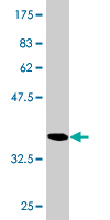 1 - RGS20 Antibody (monoclonal) (M04) AT3629a