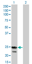 1 - RGS4 Antibody (monoclonal) (M01) AT3631a