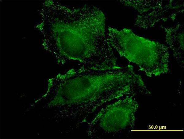 3 - RHOJ Antibody (monoclonal) (M01) AT3639a