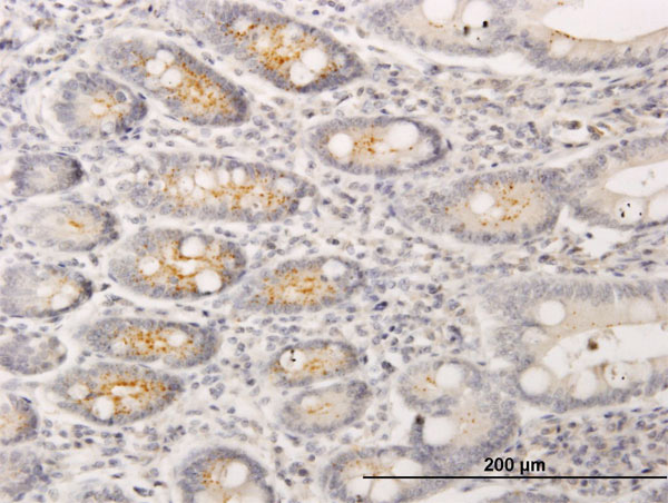 2 - RIN2 Antibody (monoclonal) (M01) AT3642a
