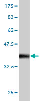 1 - RIN2 Antibody (monoclonal) (M01) AT3642a