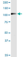 1 - RIN2 Antibody (monoclonal) (M01) AT3642a