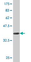 1 - RIN2 Antibody (monoclonal) (M04) AT3643a